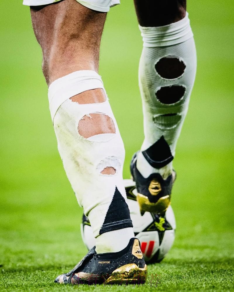 贝林穿破洞球袜属于违规 但因健康因素放宽限制